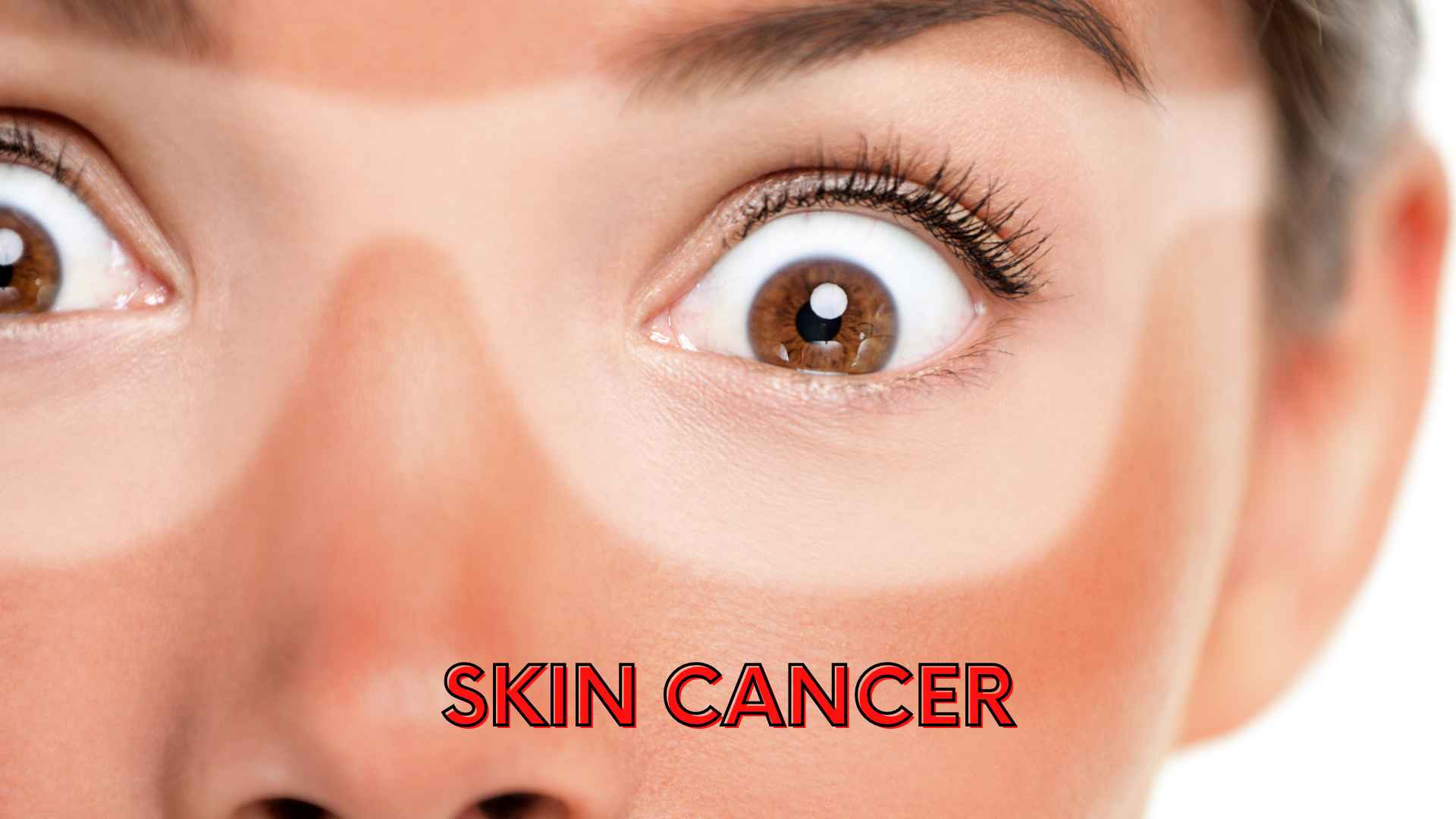 Skin cancer of the face.